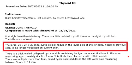 Thyroid Scan - Hui Cheng Cheah